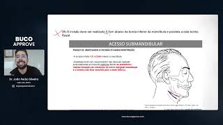 Questão de Acessos Cirúrgicos  UNICAMP 2022  Questões de Bucomaxilofacial [upl. by Teik701]