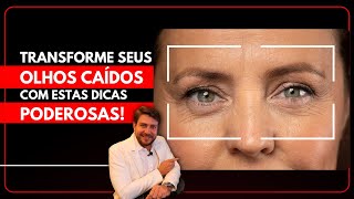 Como LEVANTAR as pálpebras caídas SEM CIRURGIA [upl. by Ycal]