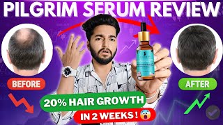 Pilgrim Redensyl and Anagain Advanced Hair Growth Serum Review [upl. by Yerxa]