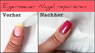 SOS  Eingerissener Nagel reparieren [upl. by Farwell]