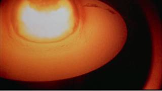 Castle Bravo  Huge thermonuclear explosion [upl. by Macguiness]