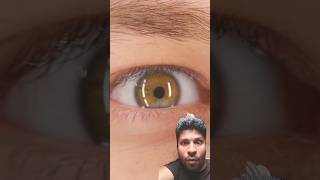 what a Eye trick funny comedy magic [upl. by Kcirtemed985]