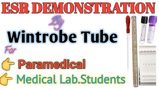 ESR Explained Wintrobe Tube Demonstration  Understanding Blood Sedimentation [upl. by De Witt]