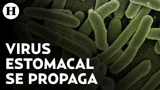 Extraño virus estomacal se propaga en EU estos son los síntomas de la shigelosis [upl. by Yssac]