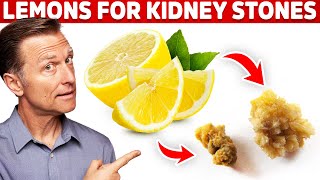 Eliminate Kidney Stones With Lemons – Kidney Stone Causes amp Lemon Benefits – DrBerg [upl. by Kinch]