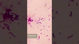 Corynebacterium Diphtheria viral biology mlt viraltrend [upl. by Treulich]