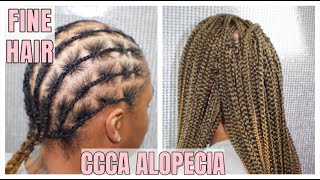 NEW TECHNIQUE  ALOPECIA  FINE HAIR  HAIR LOSS  BOX BRAIDS  DEDE AT HOME [upl. by Nylave]