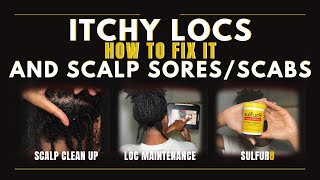 How to Fix Itchy Locs and Scalp SoresScabs [upl. by Ayotahc997]