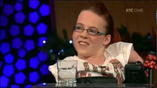 Joanne ORiordan Chats About Having Total Amelia Syndrome [upl. by Iblok621]