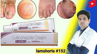 Luliconazole cream के फायदे  Luliconazole cream 1 ww uses in hindi Shorts lamshorts [upl. by Chellman775]