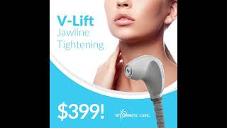 Introducing VLift Neck Tightening [upl. by Ordisy721]