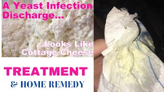 Vaginal Yeast Infection and Treatment [upl. by Notnerb]