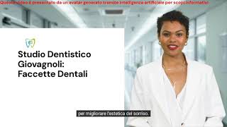 Faccette Dentali [upl. by Eelahs]