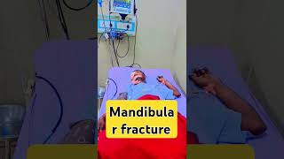 Mandibular fracture  mandular fracture surgery  mandibular surgery care [upl. by Steffane464]