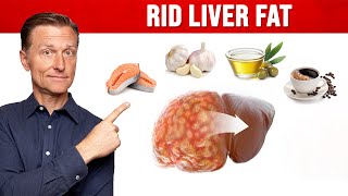 The BEST Foods for a Fatty Liver MUST WATCH [upl. by Indyc]