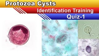 Protozoa Cysts Identification Training Quiz  Part 1 [upl. by Vasquez]