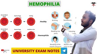 Hemophilia  Blood Clotting Disorder  Blood physiology [upl. by Sochor]