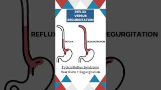 Reflux and Regurgitation  Understanding the difference biology medicalcondition [upl. by Wershba2]