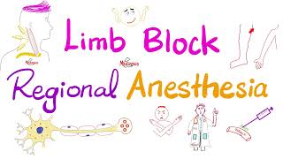 Limb Block  Peripheral Nerve Block  Regional anesthesia [upl. by Elliot182]