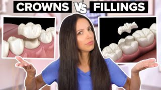 Dental Crowns Vs Dental Fillings Whats the Difference [upl. by Lehpar]