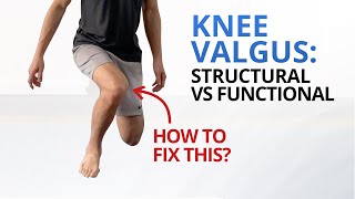 Why You Need to Fix Dynamic Knee Valgus NOW [upl. by Adel965]