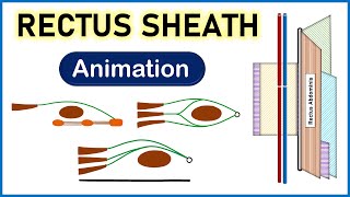 Complete 3D Animation on Rectus Sheath  Abdomen  Anatomy [upl. by Henig]