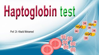 Haptoglobin Test تحليل هابتوجلوبين [upl. by Dnalloh985]