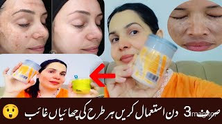 Freckles remove formula used just 2 ingredients and get fast amazing results mahajutt [upl. by Aij426]