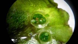 Liverwort Gemmae Cups [upl. by Cristoforo30]