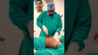 Gynaecomastia Surgery youtubeshorts trending youtubevideos short [upl. by Alien264]