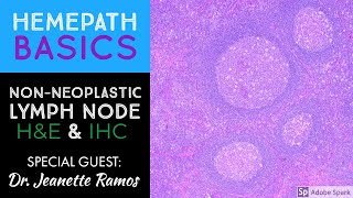 Hemepath Basics NonNeoplastic Lymph Node Histology amp Immunostains with Dr Jeanette Ramos [upl. by Warfore]