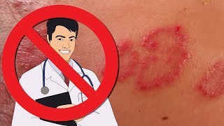 Do dermatologists really know anything or even care about psoriasis [upl. by Fraase937]