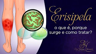 Erisipela o que é porque surge e como tratar [upl. by Navonod]