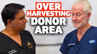 The Problem With Over Harvesting In The Donor Area  The Hair Loss Show [upl. by Fraya]