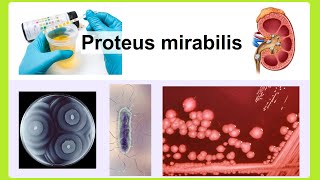 Proteus mirabilis [upl. by Auroora]