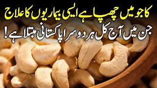 Benefits Of Cashew  Kaju K Fayde Urdu Hindi [upl. by Assylla]