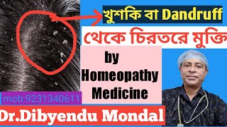 Dandruff Treatment At Home In Bangla। খুশকির হোমিও চিকিৎসা। [upl. by Hacceber]