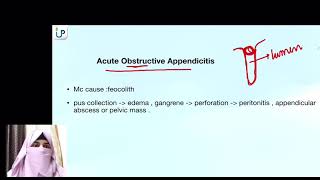 Appendicitis Surgery Demo Lecture Unani StepUp Dr Ifrah [upl. by Eiramacissej169]