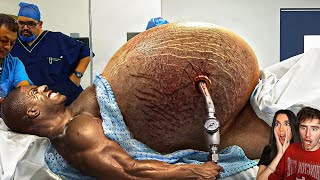 This Bodybuilder Took It WAY TOO FAR [upl. by Assiar]