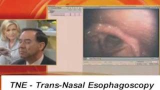 TNE TransNasal Esophagoscope Endoscopy Endoscope GMA [upl. by Abott]