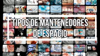 TIPOS de MANTENEDORES de ESPACIO CLASIFICACIÓN ZAPATILLA DISTAL BARRA TRANSPALATINA [upl. by Anawt196]