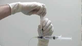 Injecting IntraVentricular Chemotherapy [upl. by Dlaniger235]