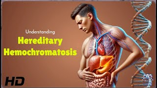 Hereditary Hemochromatosis Are You at Risk [upl. by Eahsed]