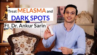 How to treat melasma hyperpigmentation amp dark spots  Dr Ankur Sarin ft Fixderma [upl. by Frasier613]