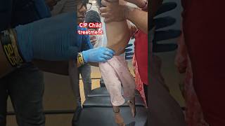 CP Child treatment drrajneeshkant chiropractor worldfamouschiropractor [upl. by Loyce249]