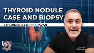 Thyroid Nodule case and biopsy explained by Dr Nikravan [upl. by Akemit]