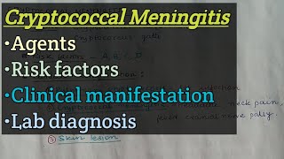 Cryptococcal meningitis  Agents  Risk factors  Clinical manifestation  Lab diagnosis [upl. by Anthia644]