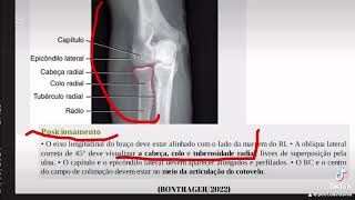 OBLÍQUA EXTERNO DO COTOVELO [upl. by Asilem]