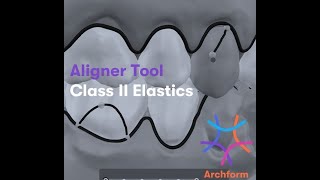 Aligner tool Archform class II elastica [upl. by Lativa]