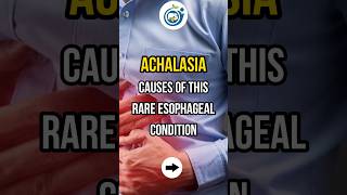 ACHALASIA CAUSES OF THIS RARE ESOPHAGEAL CONDITION shorts achalasia esophagus doctor [upl. by Damali219]